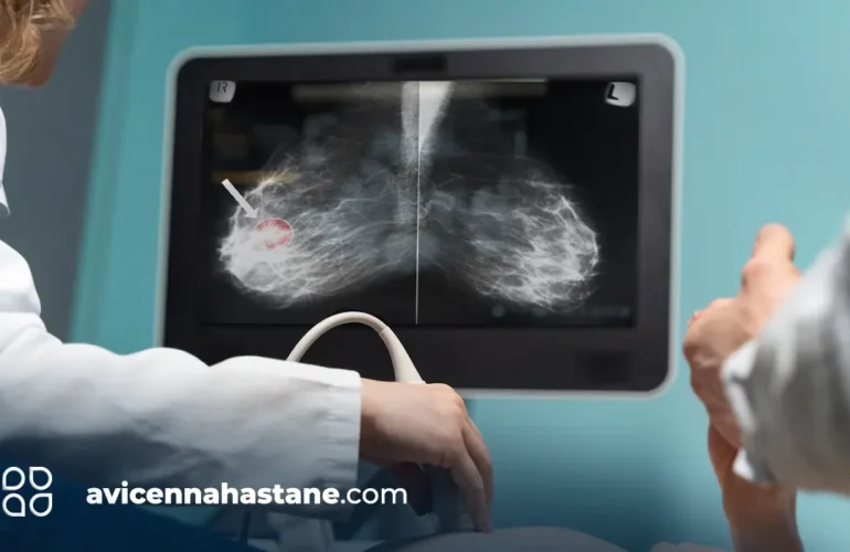 ultrason,doppler,fiyatlar,avicenna