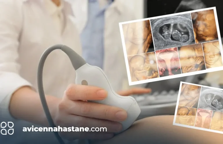 prematüre-bebek-renkli-doppler