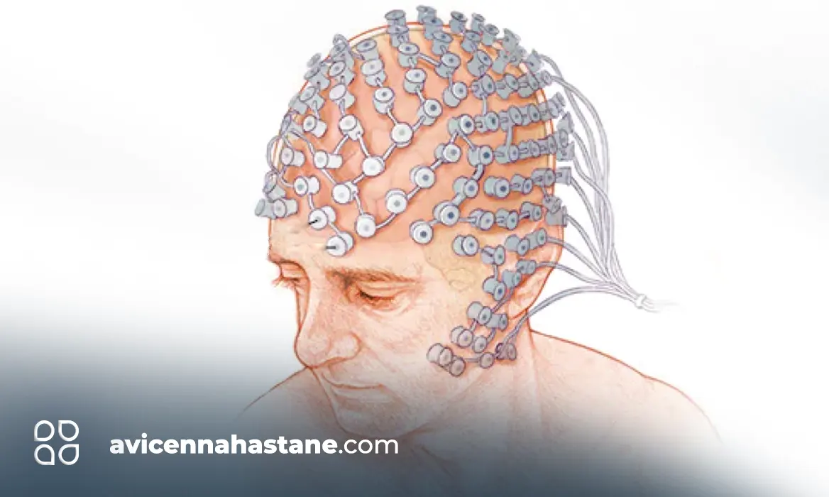 eeg nedir