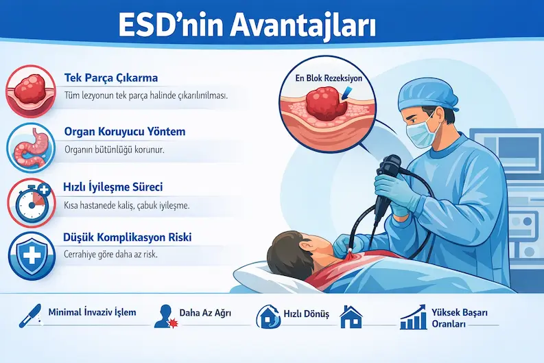 endoskopik submukozal diseksiyon esd avantajlari