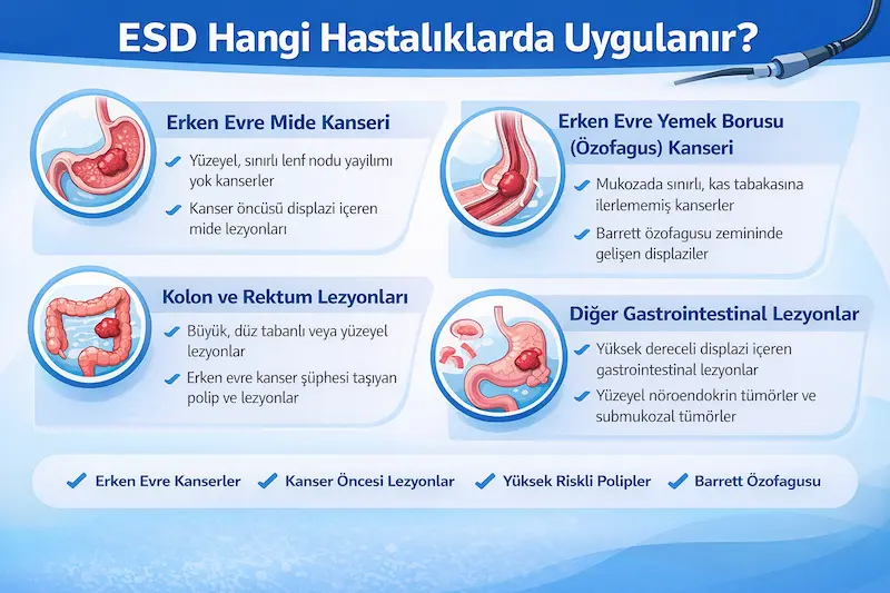 ESD yöntemi hangi hastalıklarda kullanılır?